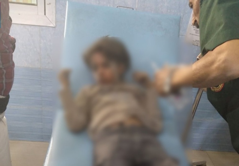 إصابة طفلين إثر قصف حوثي استهدف أحياء سكنية شرقي تعز