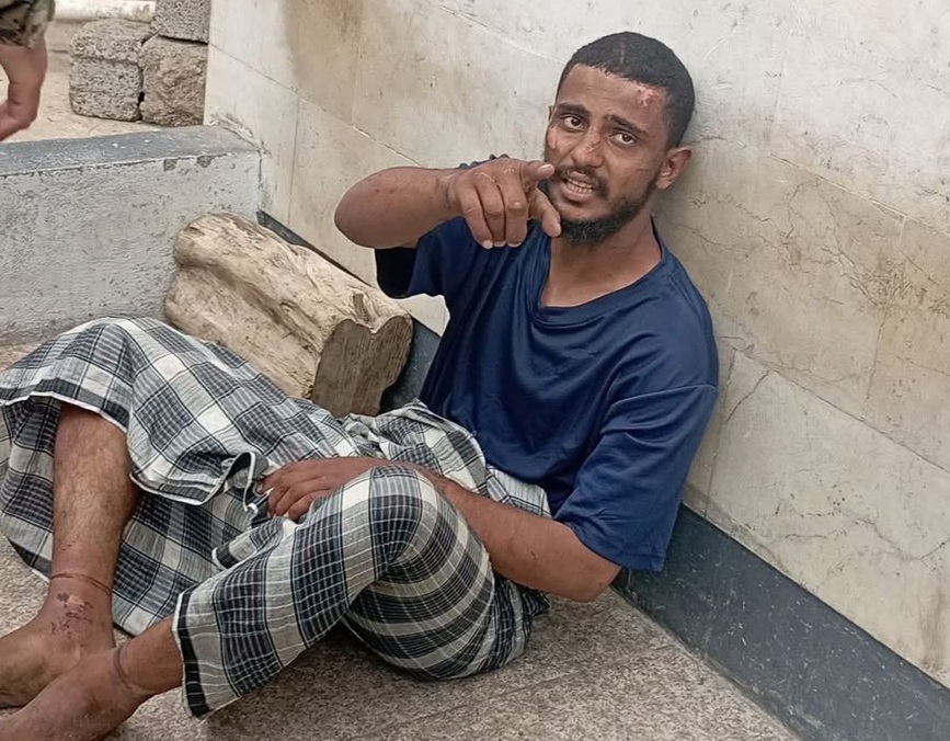 دعوات لتحقيق عاجل.. العثور على ضحية تعذيب مجهول الهوية في عدن يفتح ملف السجون غير القانونية