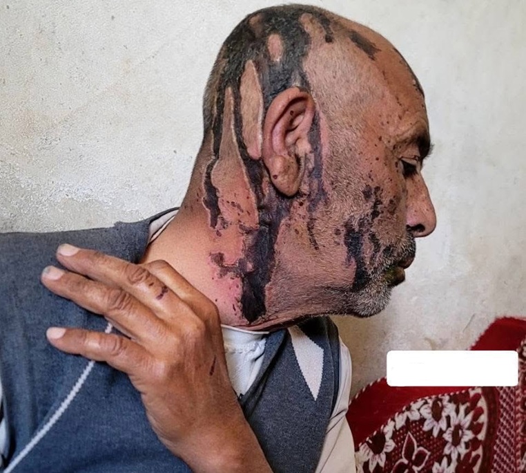 جريمة مروعة في عمران.. شابان عائدان من دورة حوثية يعتديان على والدهما بطريقة وحشية